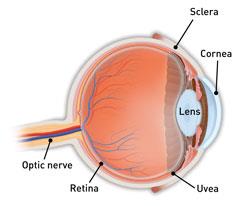 Uveitis | Associated Retina Consultants | Retina Care Phoenix, AZ ...