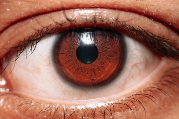 How Do You Know If You Have a Macular Hole? featured image
