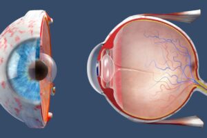 Exploring the Role of the Retina in Vision-Anatomy and Function featured image