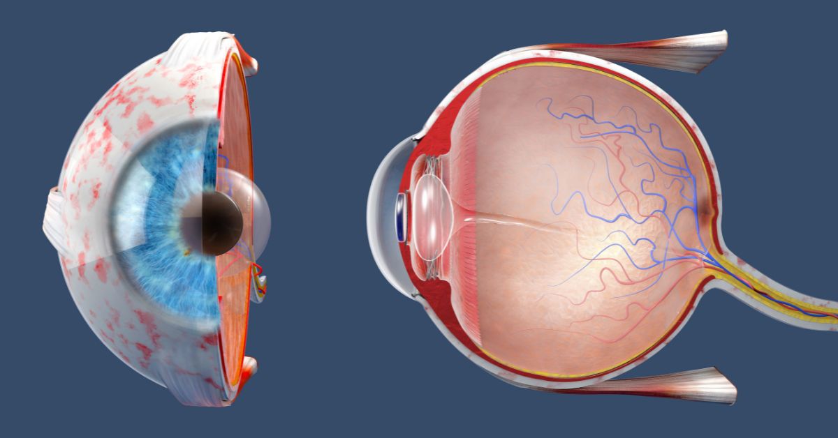 The Role of the Retina Associated Retina Consultants Associated