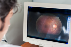 The Link Between Diabetes and Retinal Health: Managing Diabetic Retinopathy featured image