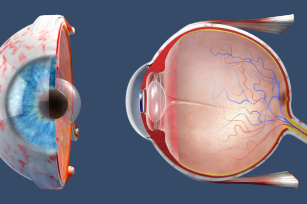 Retinal Detachment-Signs, Emergency Response, and Treatment Approaches featured image