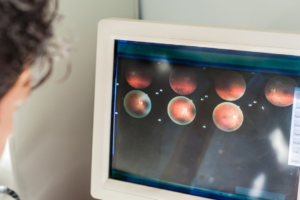 Floaters and Flashes: When to Worry About Your Retinal Health featured image