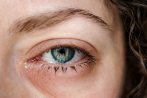 Top 5 Common Retina Diseases: Causes, Symptoms, and Treatment Options featured image