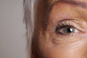 What is Lattice Degeneration? featured image