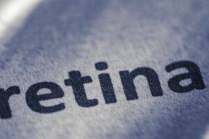 Where is the Retina Located Inside the Eye? featured image