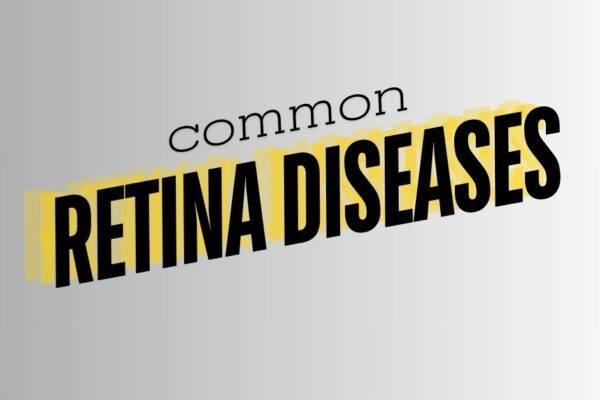 Common Retina Diseases featured image