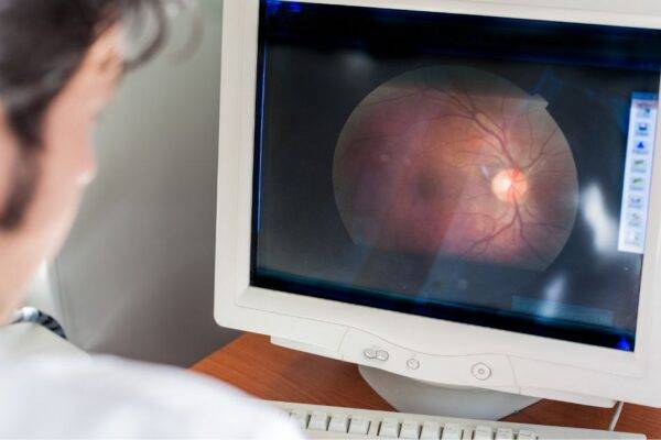 How Often Should You Get Retina Checks If You’re High Risk? featured image