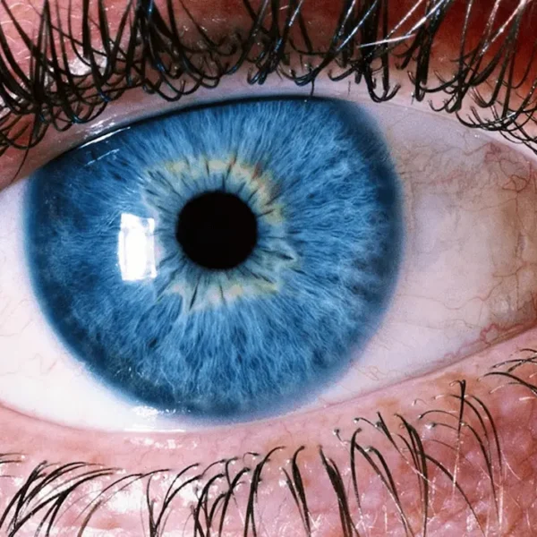Inherited Retina Diseases thumbnail